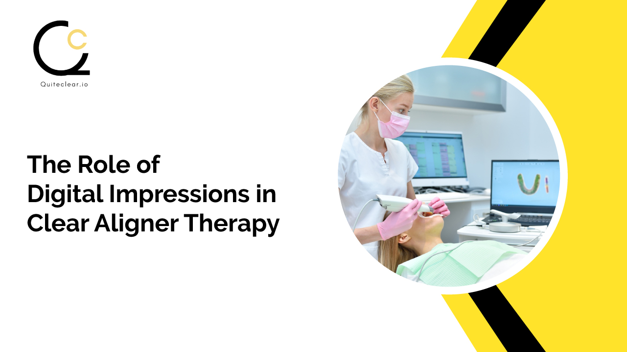 Role of Digital Impressions in Clear Aligner Therapy