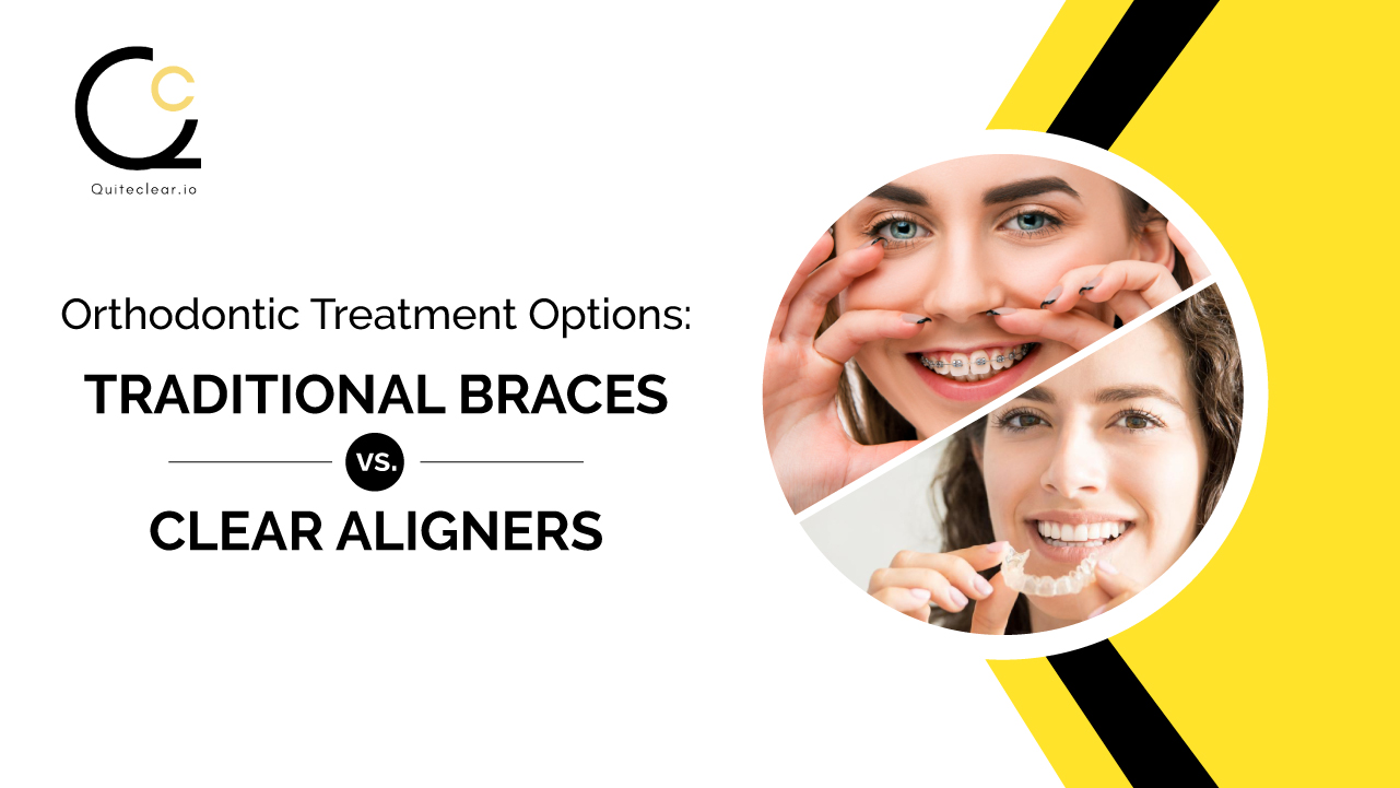 Orthodontic Treatment Options: Traditional Braces vs. Clear Aligners