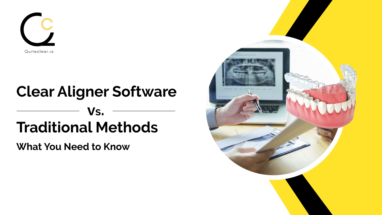 Clear Aligner Software vs. Traditional Methods: What You Need to Know
