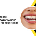 How to Choose the Right Clear Aligner Company for Your Needs