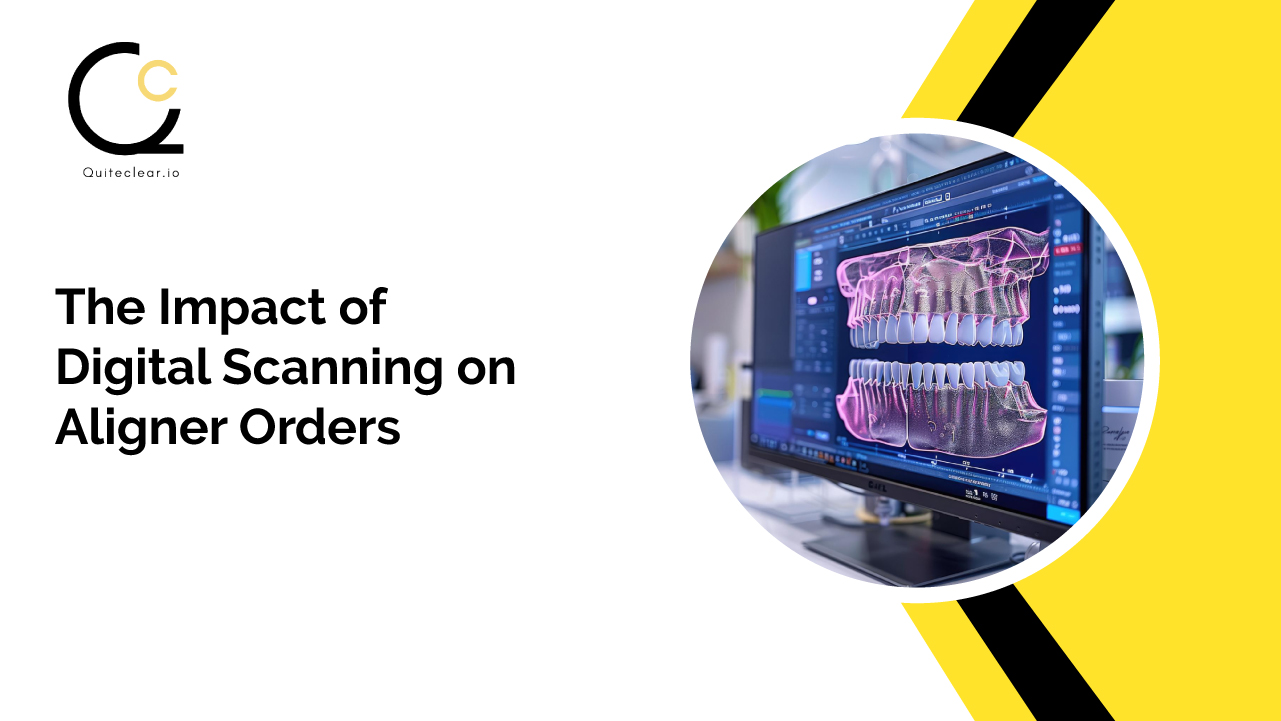 The Impact of Digital Scanning on Aligner Orders