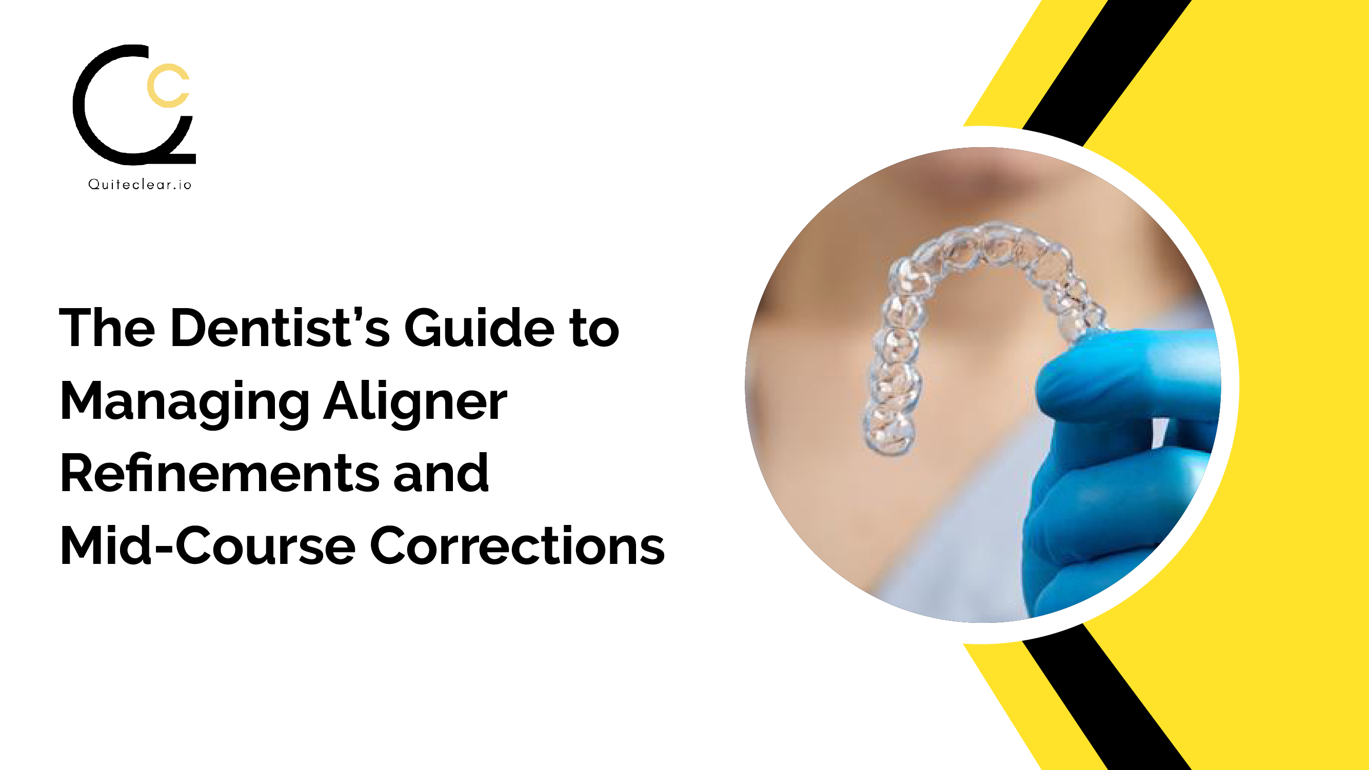 The Dentist’s Guide to Managing Aligner Refinements and Mid-Course Corrections