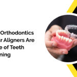 Clear Aligners