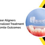 Custom Clear Aligners