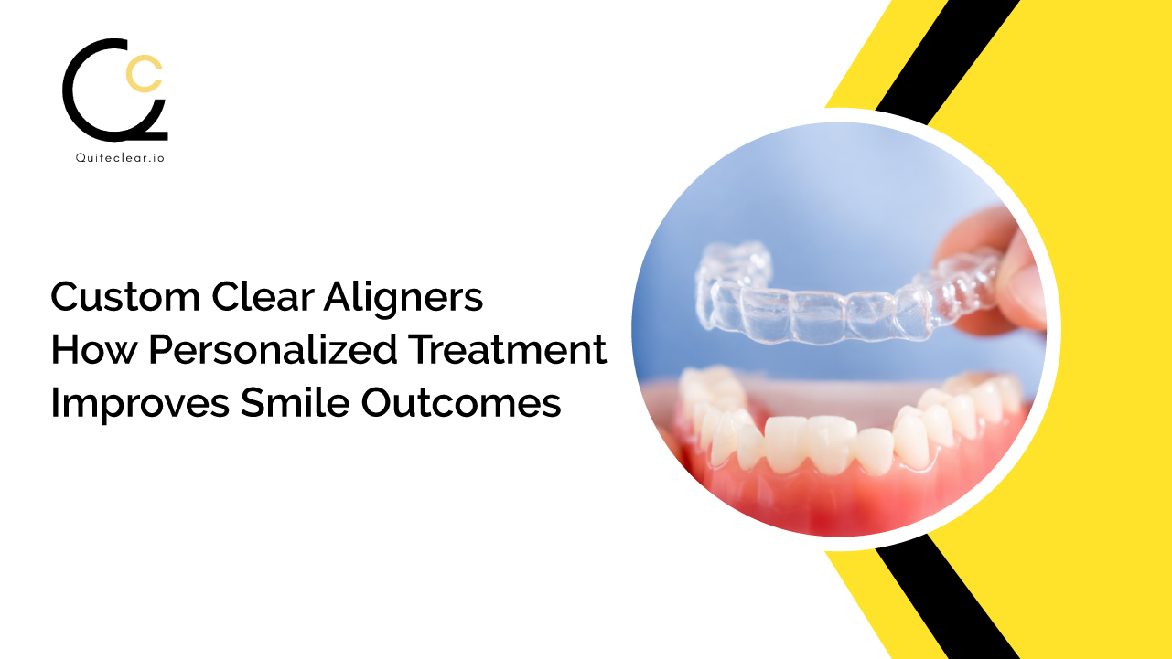 Custom Clear Aligners