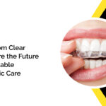 Custom Clear Aligners