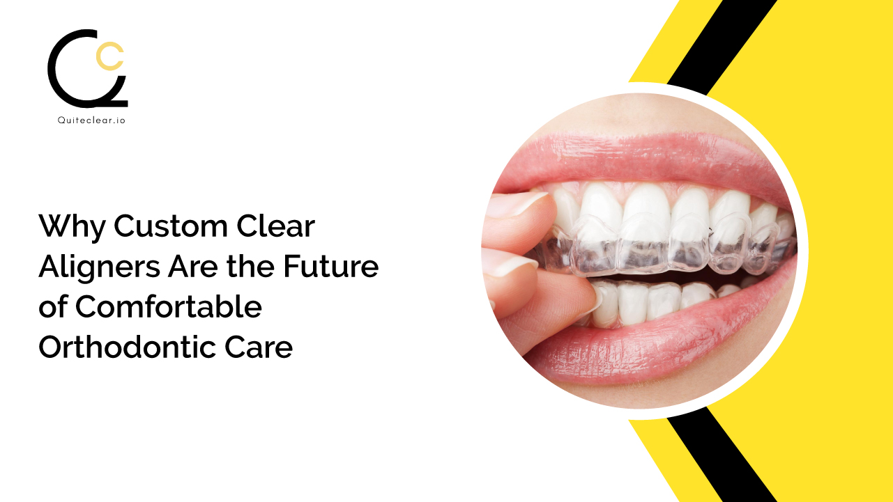 Custom Clear Aligners