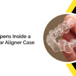 What Happens Inside a Failed Clear Aligner Case?